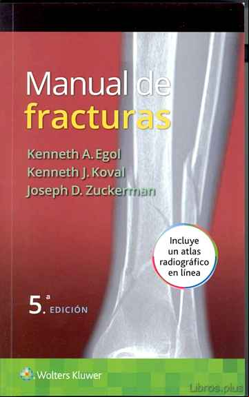 Descargar gratis ebook MANUAL DE FRACTURAS (5ª ED.) en epub